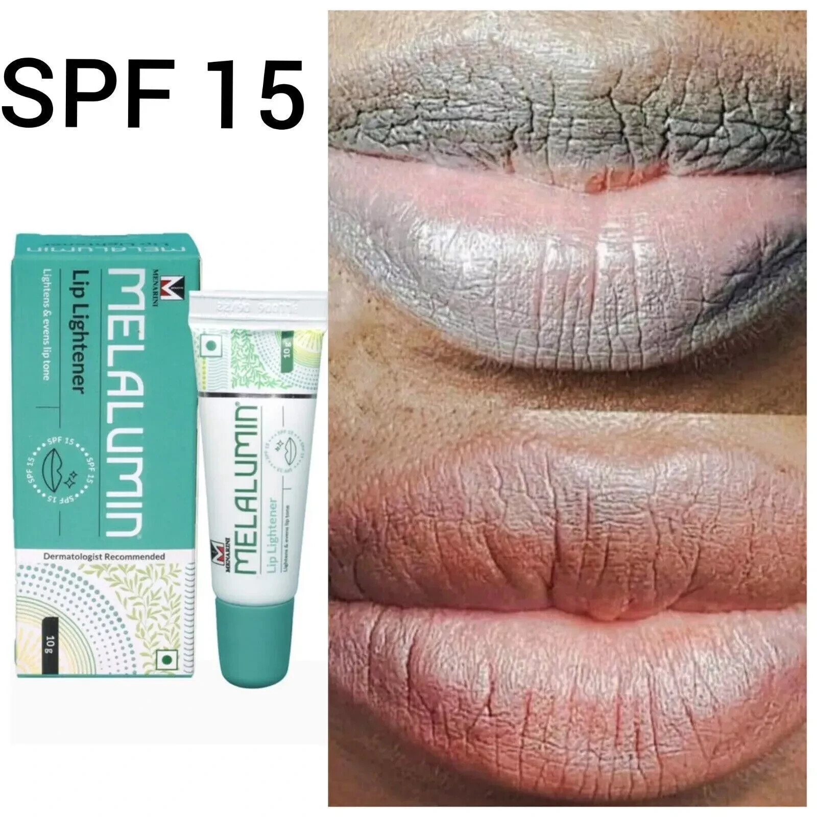 Melalumin Lip Lightener help Lighten & Brighten Dark or Discolored Lips SPF 15