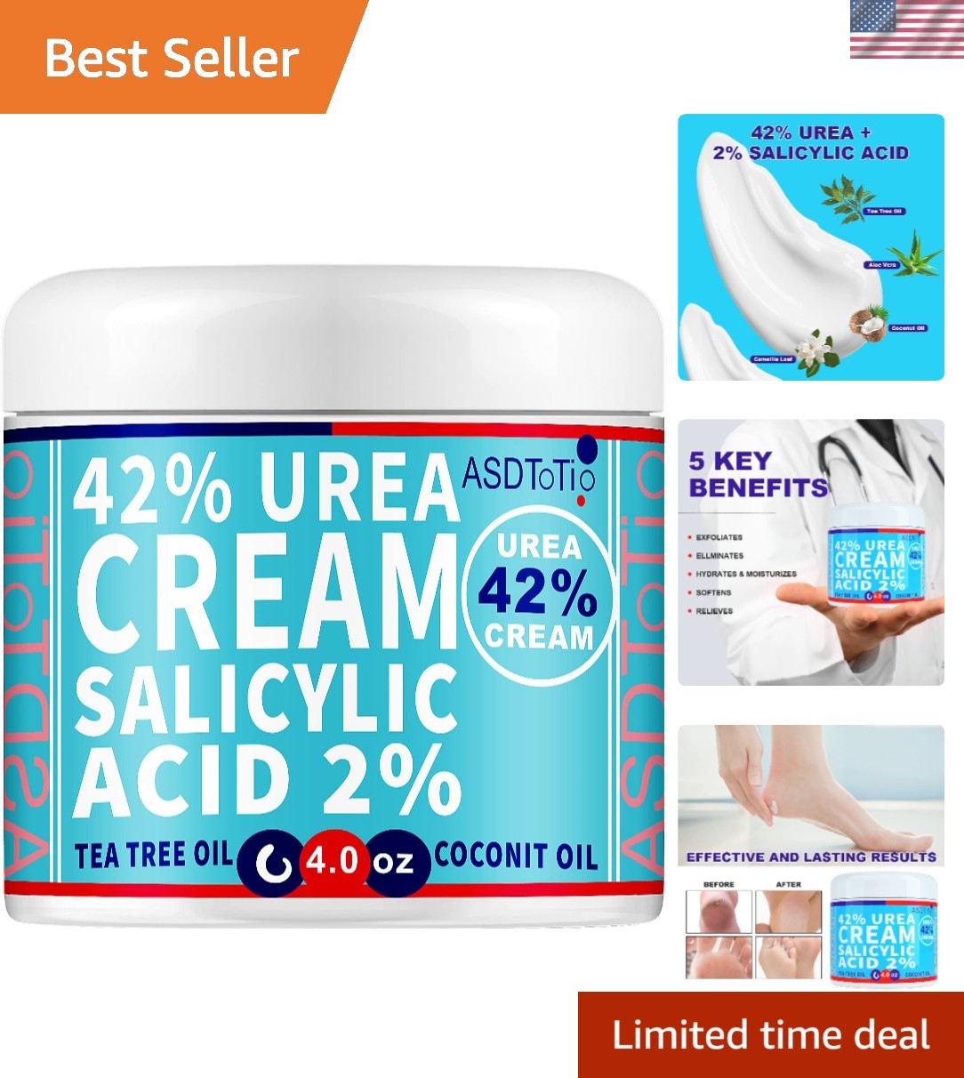 42% Urea Foot Cream – Soothe & Hydrate Your Feet – Natural Coconut Scent 4 oz