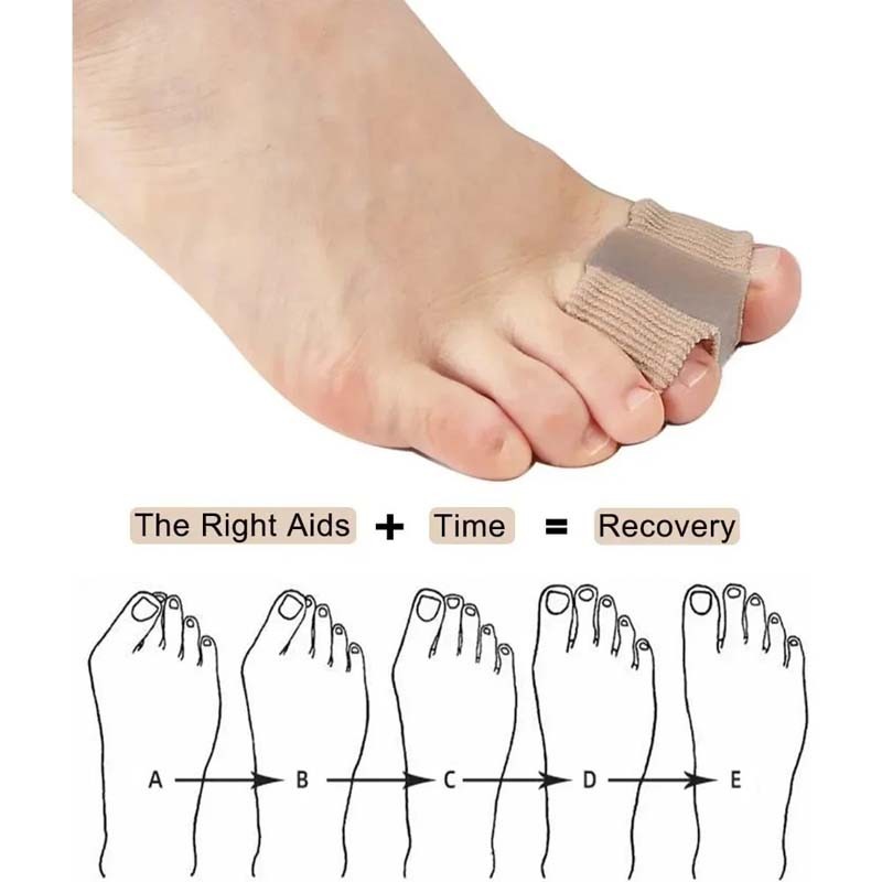 5-10PCS Big Toe Separators for Pain Relief, Bunion Corrector Spacers Straightene