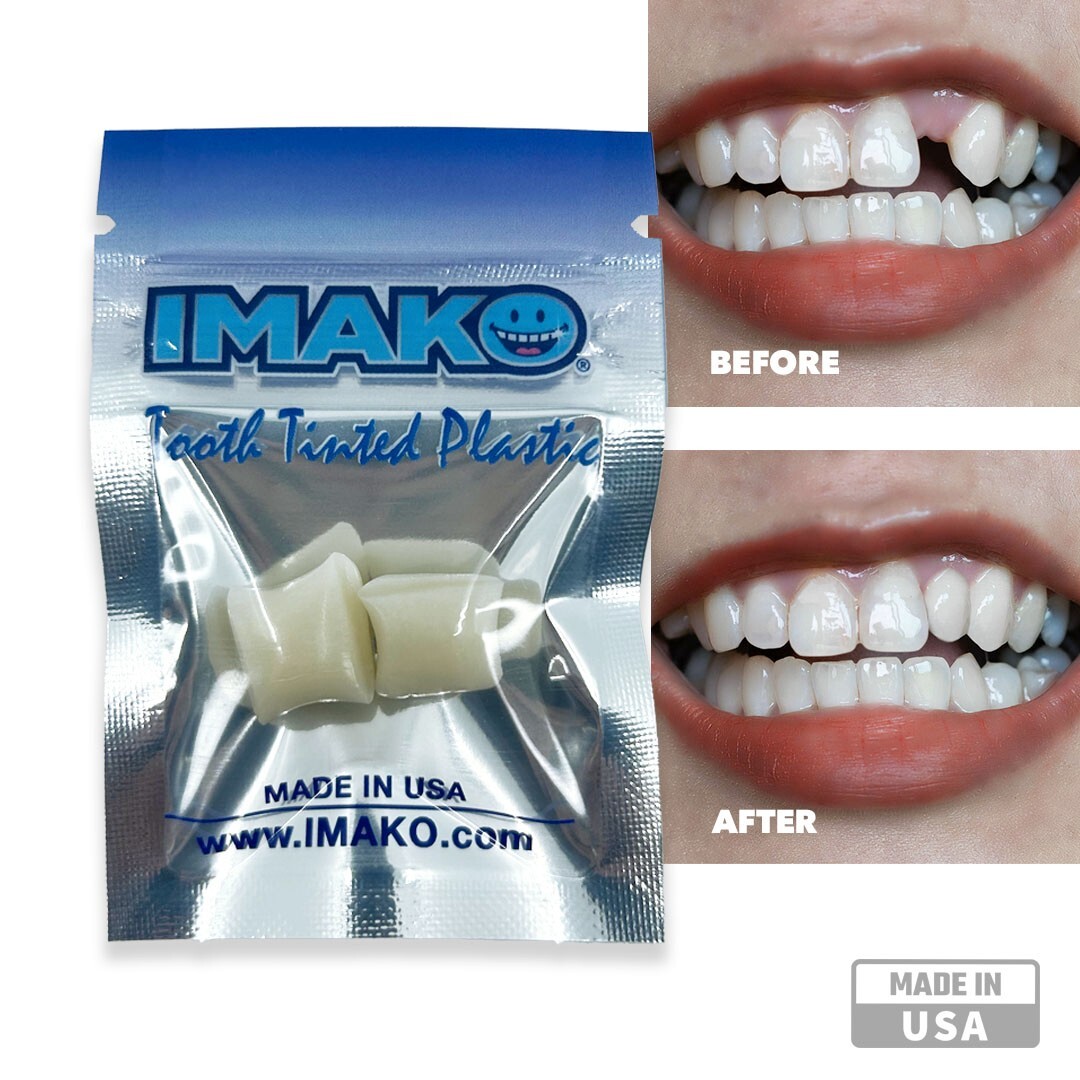 Imako® Tooth Tinted Plastic – Temporary Tooth – Fix Chipped Teeth, Gaps in Teeth