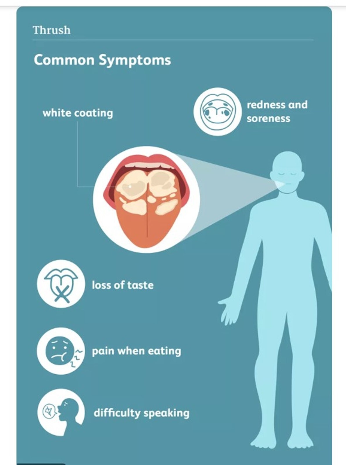 CANDIDIASIS FUNGUS – VAGINAL YEAST- Prevent and Treat-