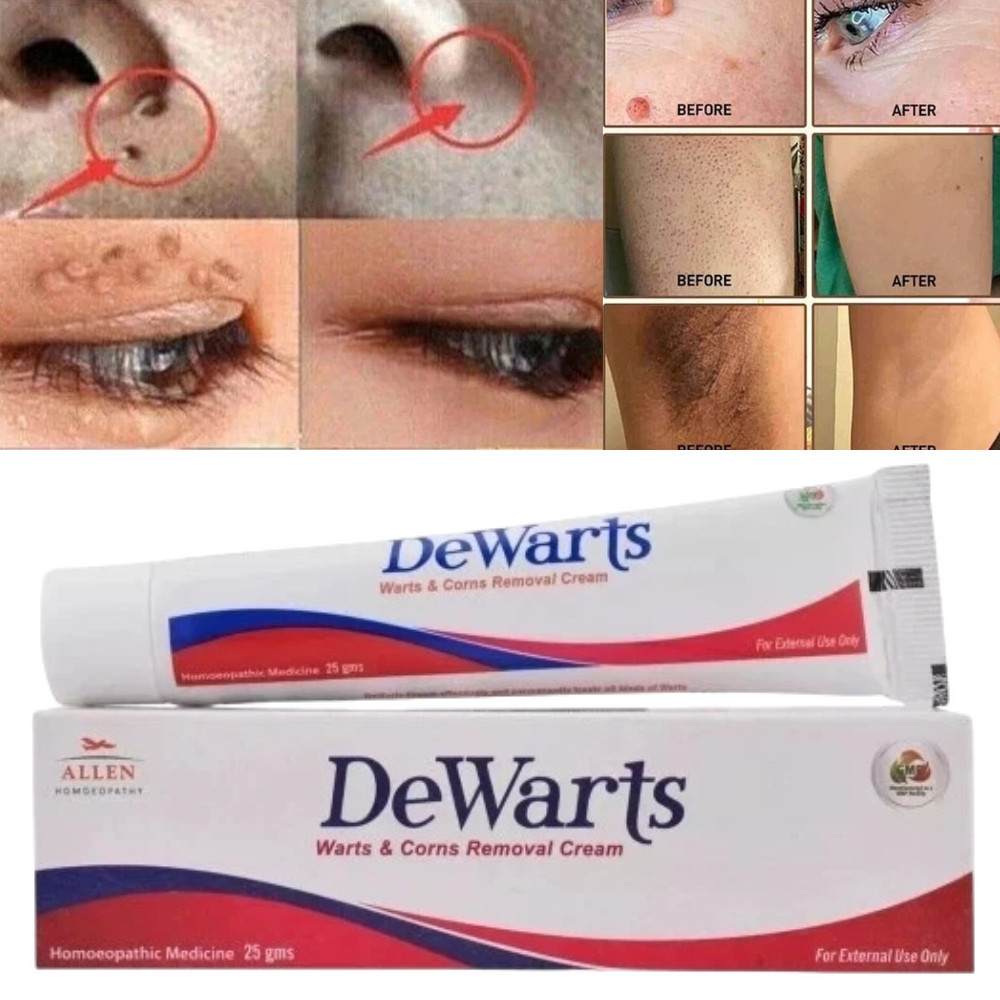 Genital Wart & HPV Removal Cream 25 gm improve skin texture for men & women