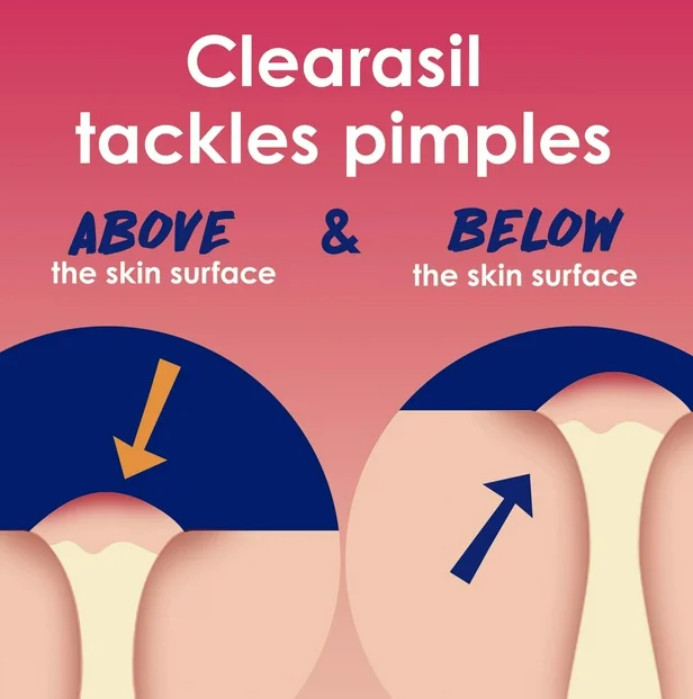 Clearasil Salicylic Acid Rapid Rescue Deep Treatment Acne Pads, 90 count