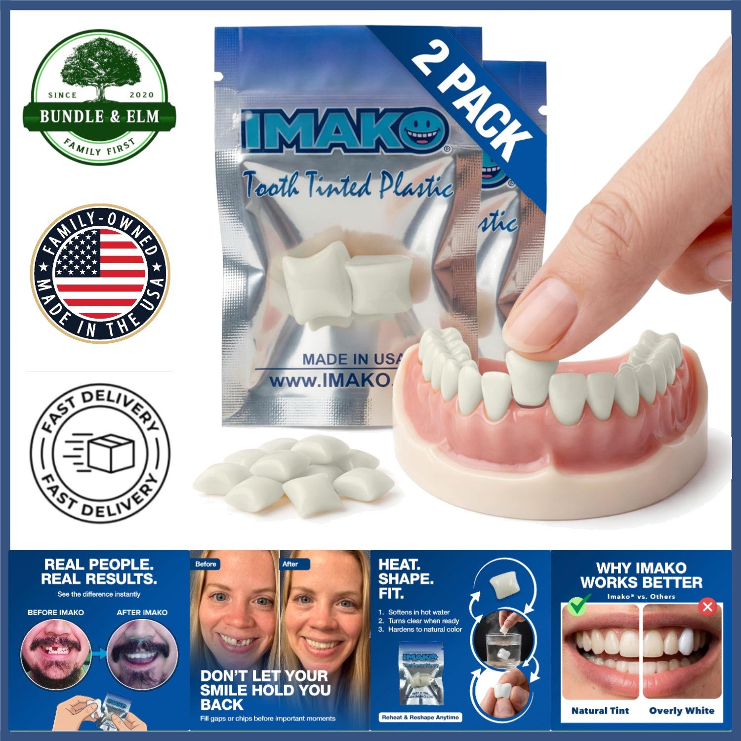 Moldable Temporary Teeth for Cosmetic Dental Repair – Easy to Use and Reheat