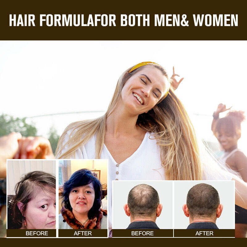 HAIR FAST GROWTH HERBAL PILLS PREVENT ANTI LOSS STIMULATE VITAMINS PILLS 5000MG