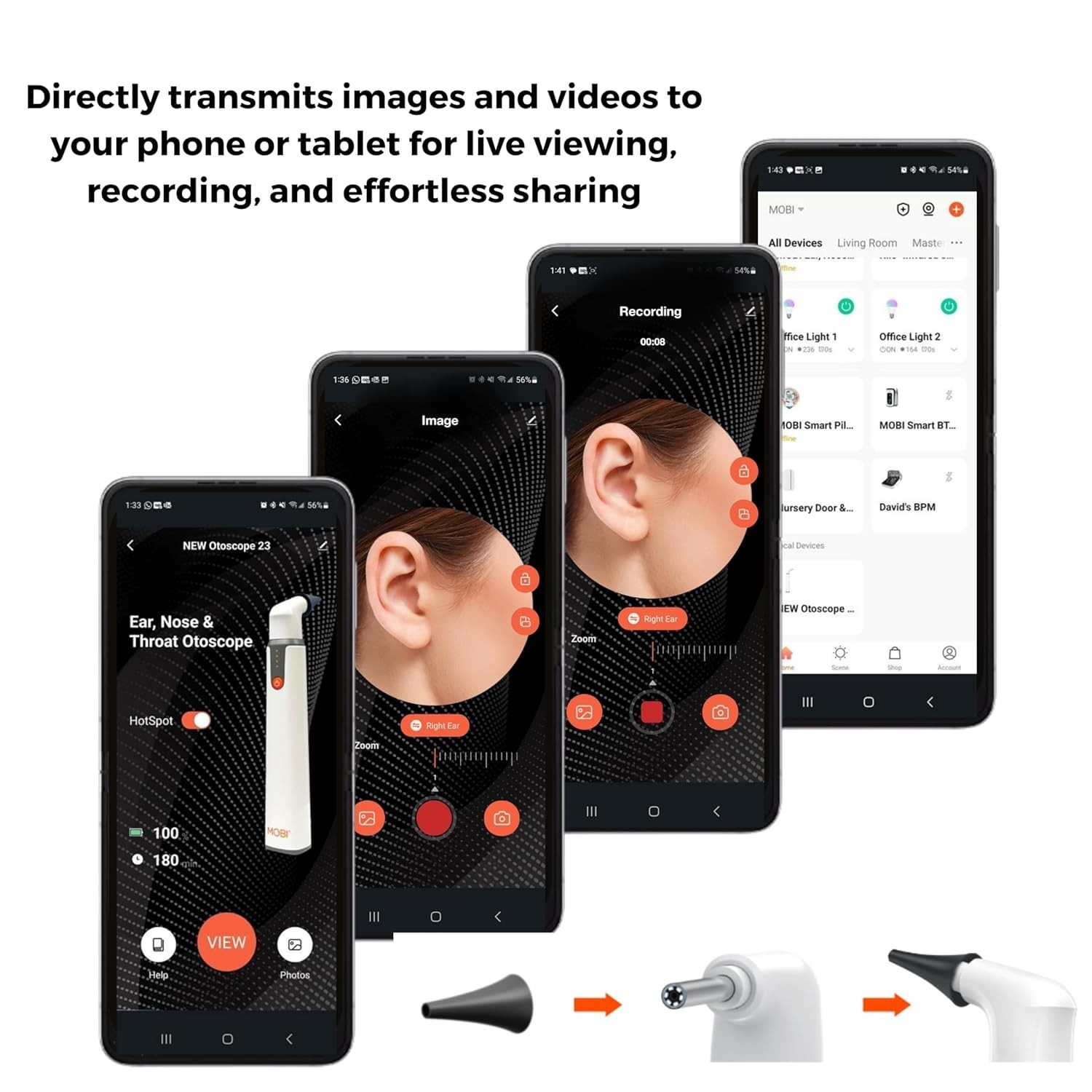 Mobi HD Smart Otoscope Camera – Ear Nose Throat Scope for People & Pets, 1080P