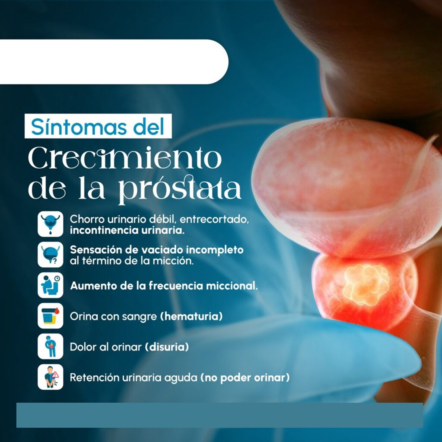 NATURAL HELP FOR ENLARGED PROSTATE (BPH) – 100% HERBAL FORMULA – MADE IN USA