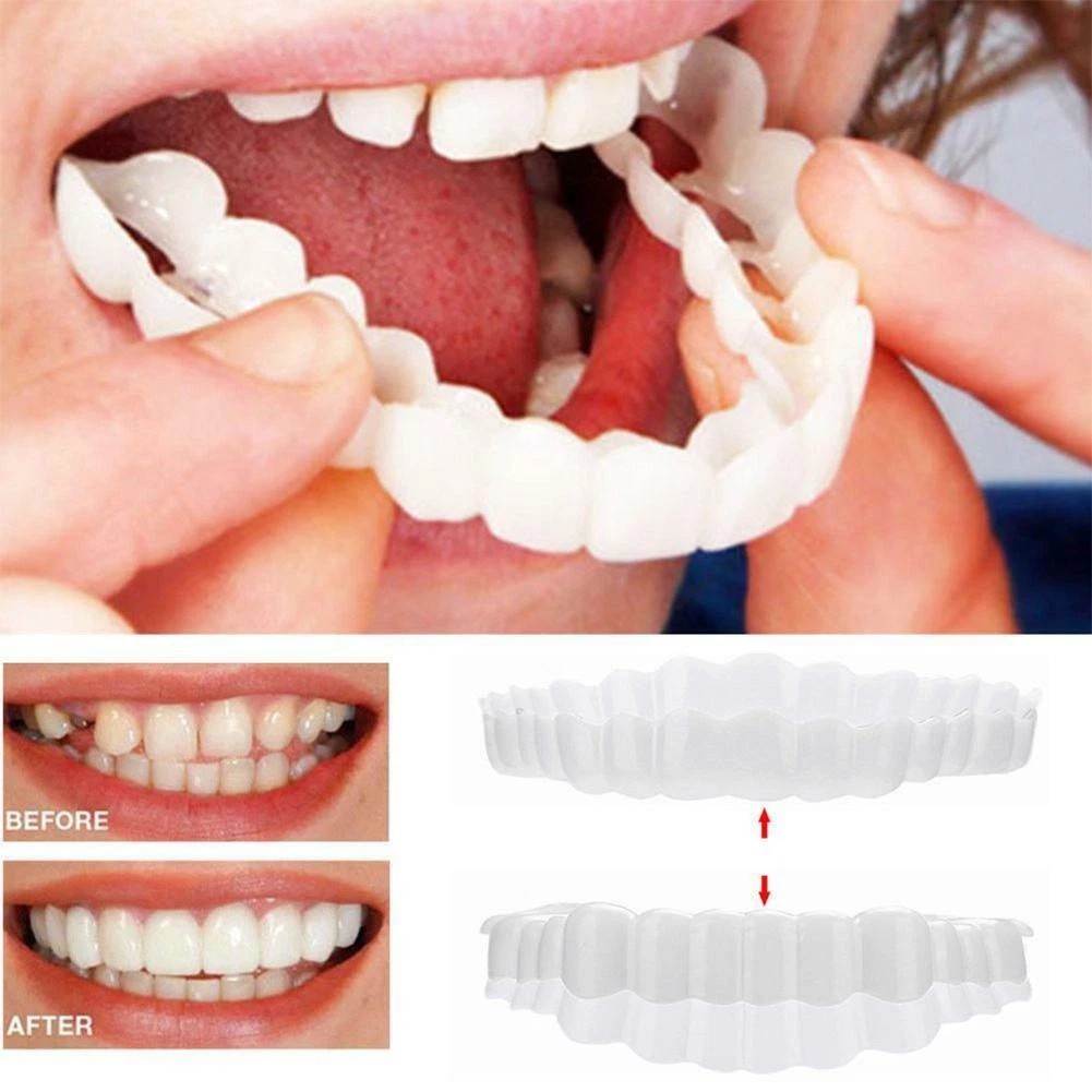 2pcs Teeth Brace Temporary Smile Magic Comfort Fit Cosmetic Denture Teeth