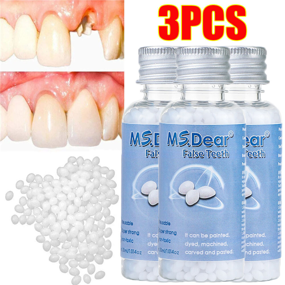 3X Tooth Repair Kit – Temporary Teeth Replacement Kit for Missing & Broken Teeth