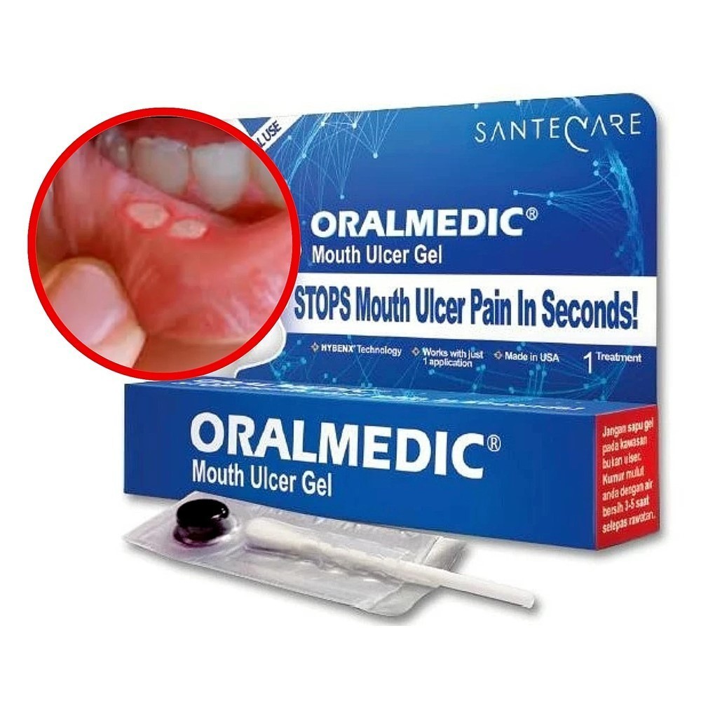 1-12 Pcs Oralmedic Mouth Ulcer Gel 1 Treatment Fast Pain Relief Made in USA