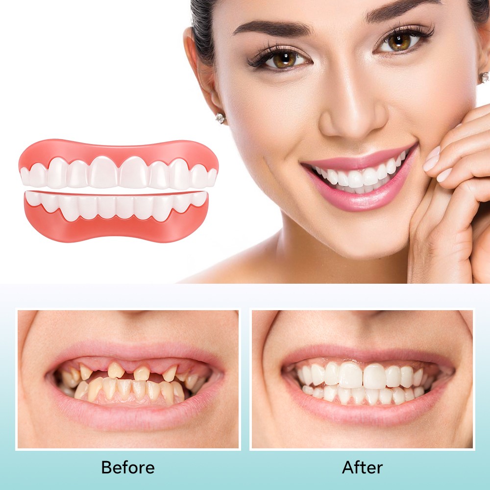 Denture Gum & Mold Kit Moldable False Teeth Veneers Upper Lower for Women Men