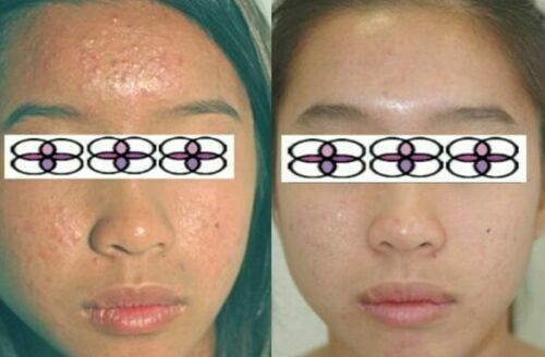 10-20-30-40-50-60-70% Glycolic Acid Night Cream 2oz/ 60ml Aging/Acne/scar