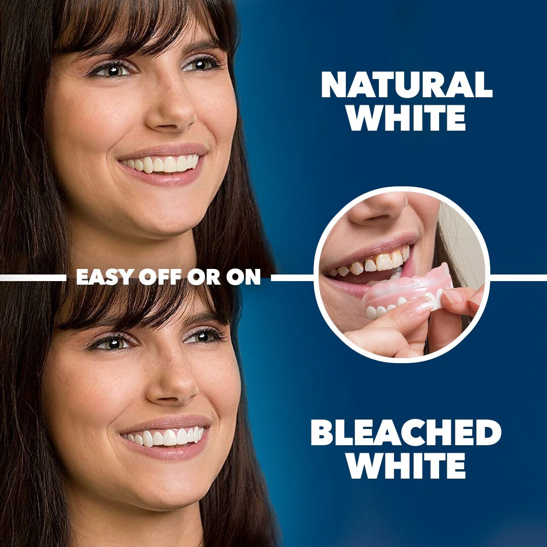 Imako® Temporary Teeth Kit – Large Size Bleached Color