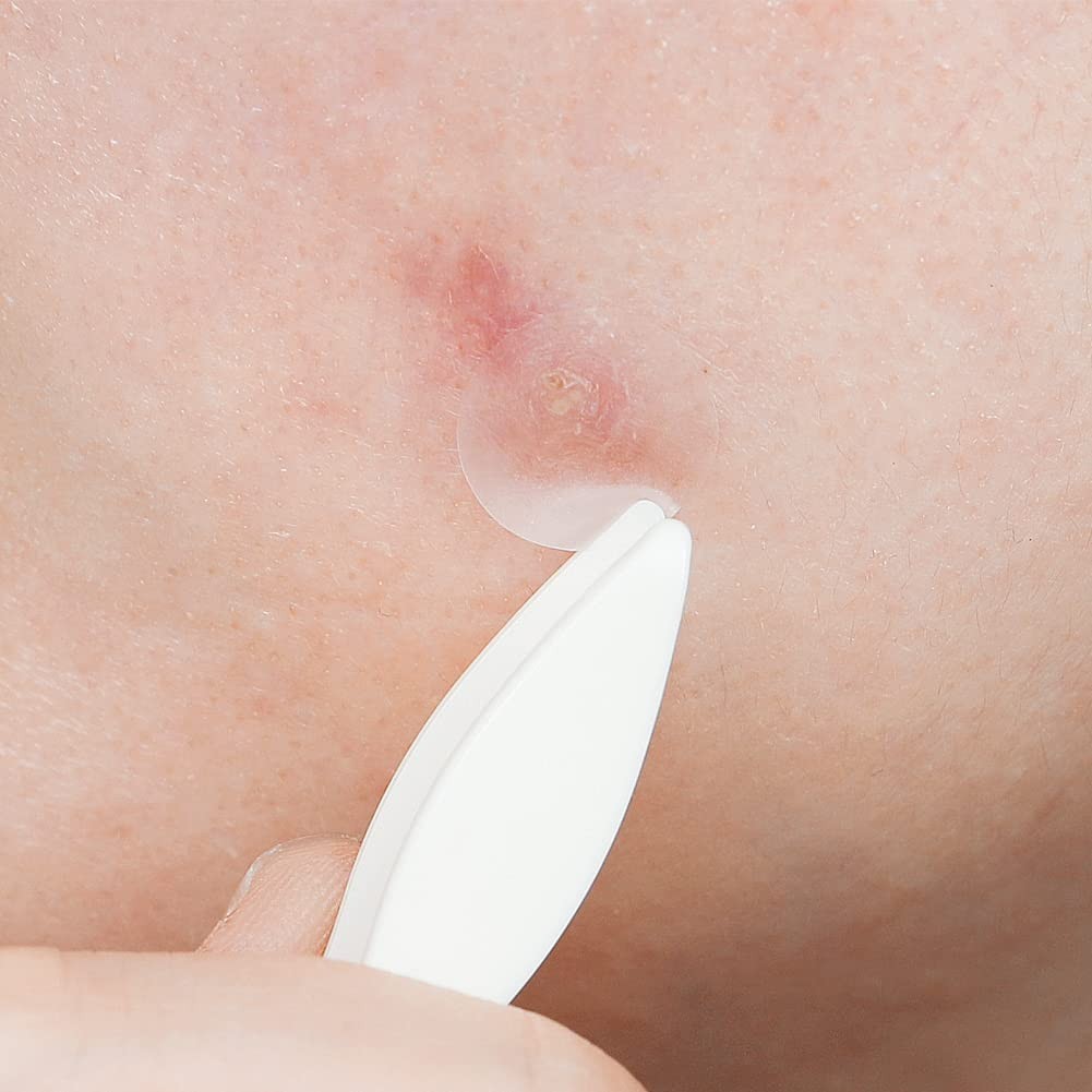 Effective Hydrocolloid Acne Spot Patch – 12mm | & Not Tested on Animals