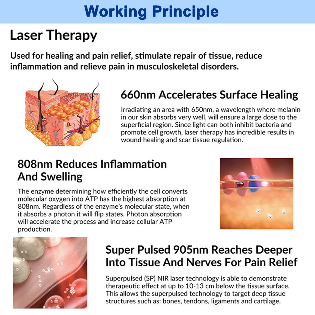 205W Pro Cold Laser NIR Light Physiotherapy for Arthritis Pain 905nm 808nm 660nm