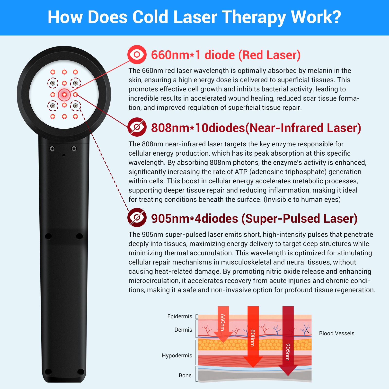 25W Super Pulsed Laser Therapy 905nm 808nm 660nm LLLT Device for Pain Relief