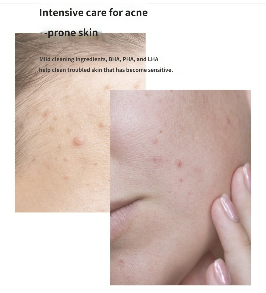 VANCOR:dr Acne BHA Foam Cleanser 120 ml / 4fl.ol Keratin +Trouble Care K-beauty