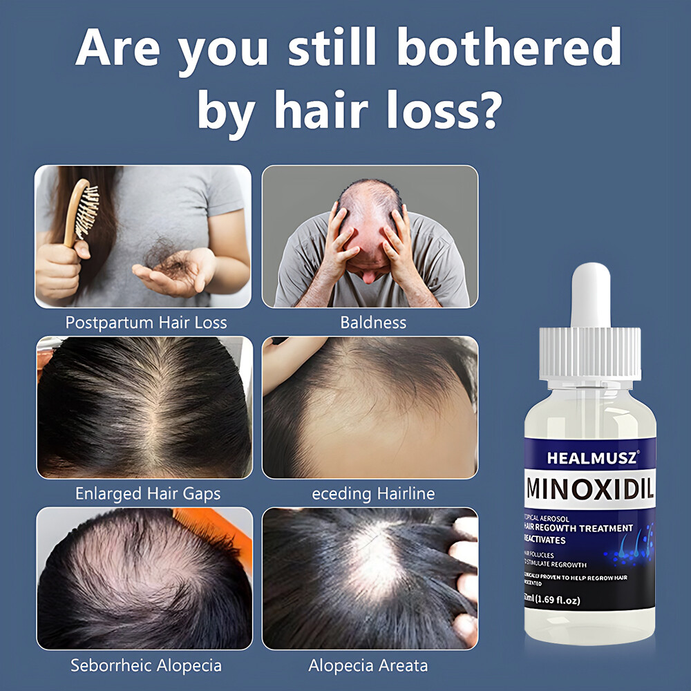 6PCS MINOXIDIL 5% EXTRA STRENGTH HAIR REGROWTH TREATMENT FOR MEN 6 MONTHS SUPPLY