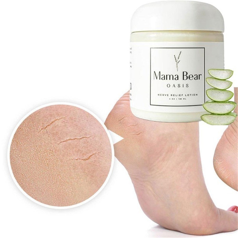 Mama Bear Oasis Lotion – Nerve Relief Cream for Foot, Hands, Legs, Natural Care