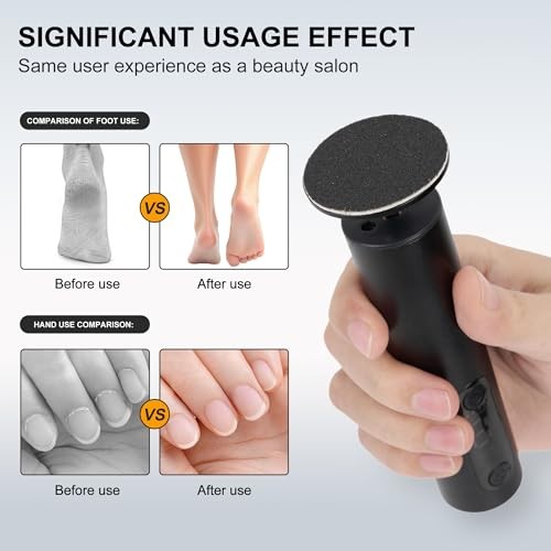 Electric Foot Callus Remover, Adjustable Speed 1 Count (Pack of 1) Obsidian