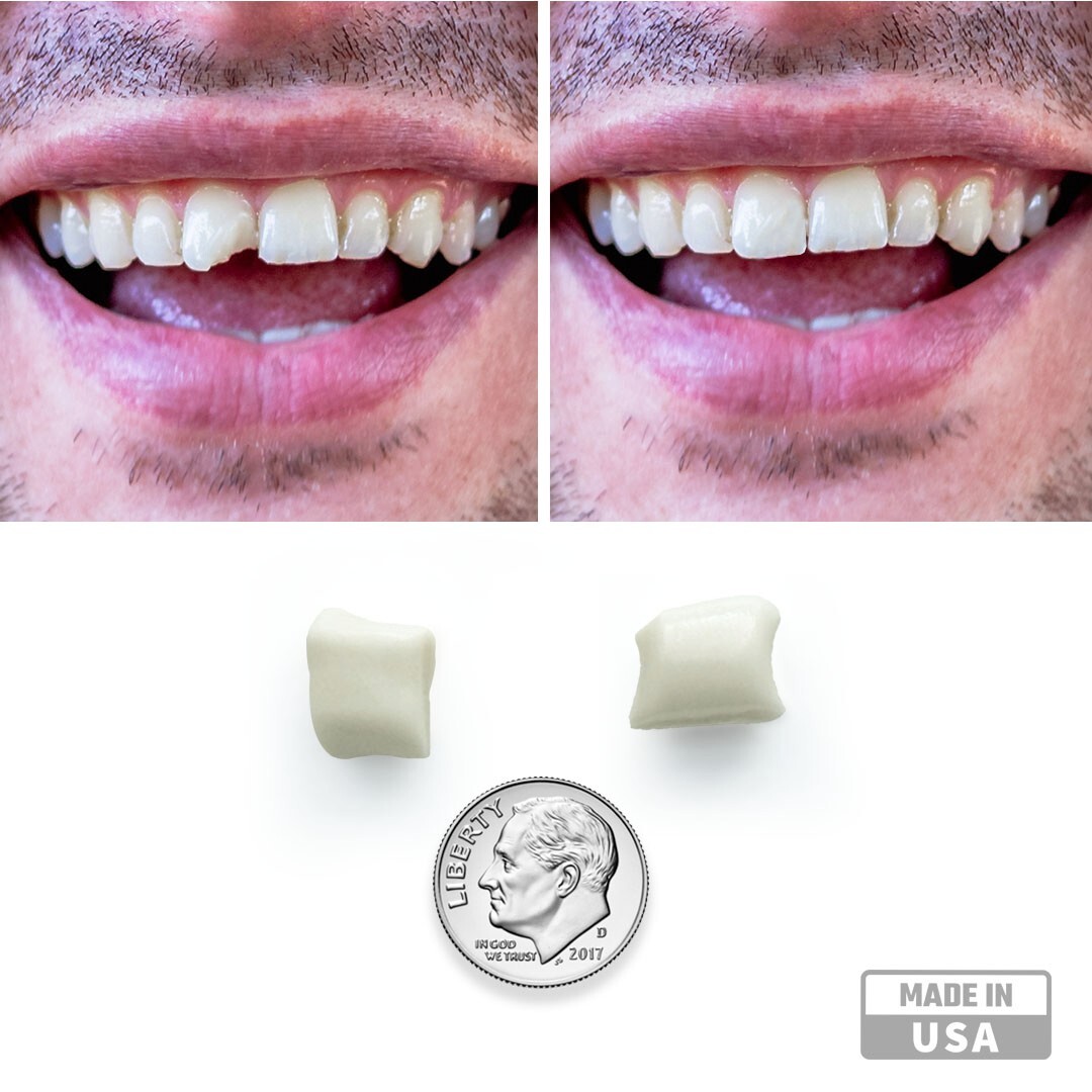Imako® Tooth Tinted Plastic – Temporary Tooth – Fix Chipped Teeth, Gaps in Teeth
