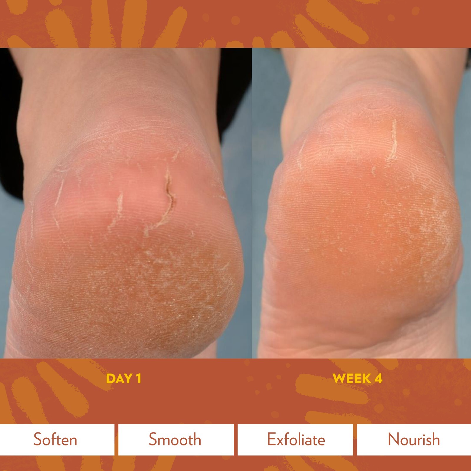 Nu Skin NuSkin Epoch Sole Solution Foot Treatment [3pk] Exp 02/2025, NEW SEALED