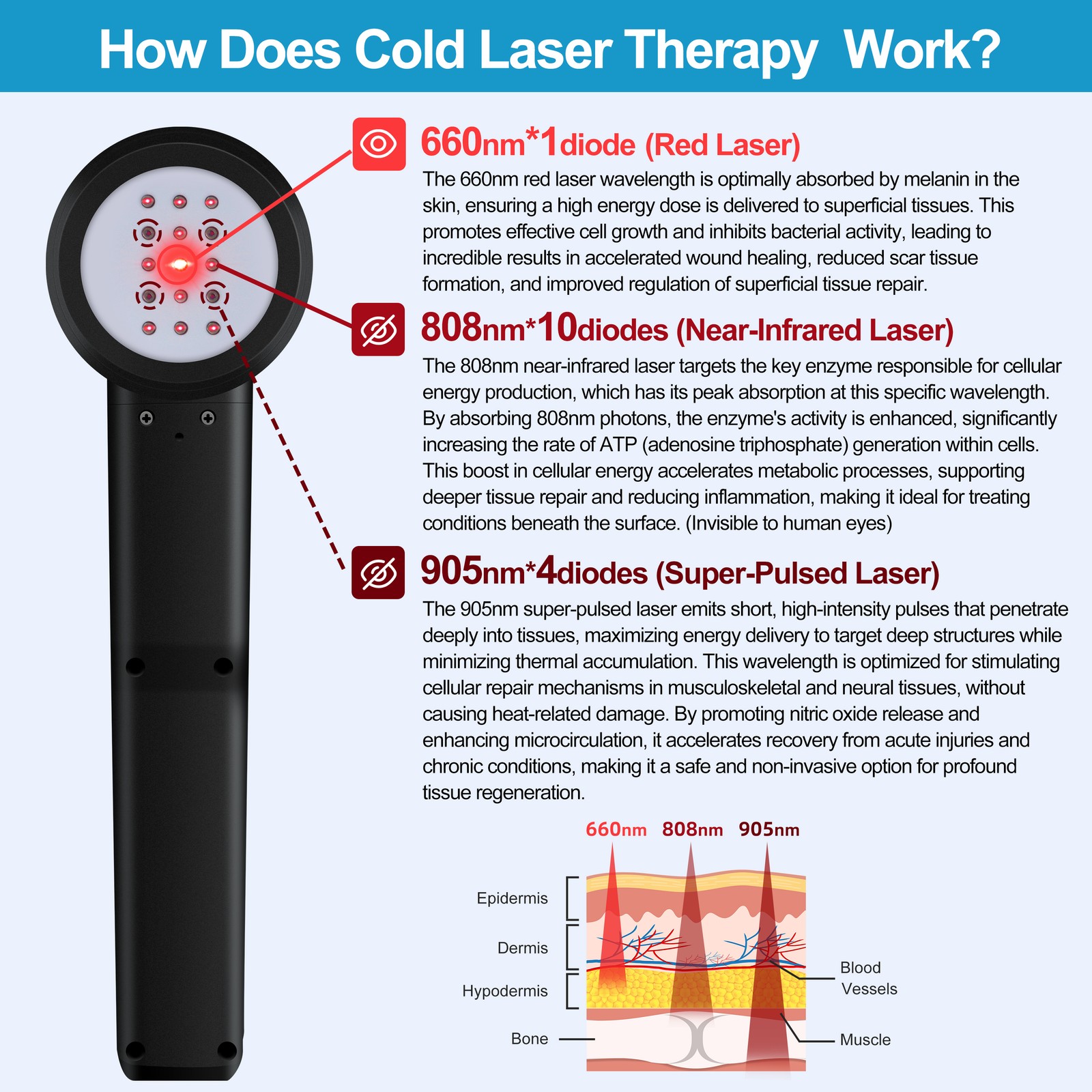 305W Super Pulsed Laser Therapy Device 905nm 808nm 660nm for Ligament Tears