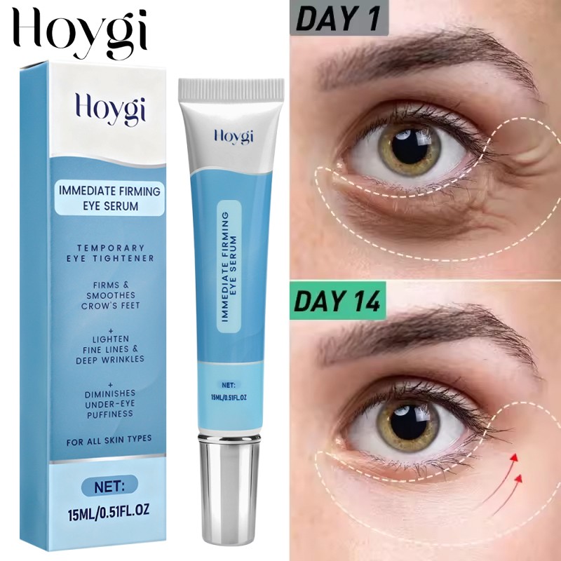 Under Eye Cream Remove Dark Circles Bags Face Lines Ageless Wrinkles Puffy Eye~