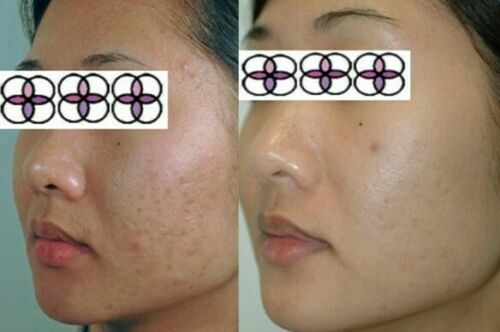 10-20-30-40-50-60-70% Glycolic Acid Night Cream 2oz/ 60ml Aging/Acne/scar