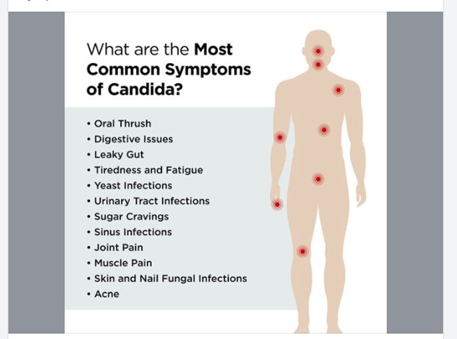 CANDIDIASIS FUNGUS – VAGINAL YEAST- Prevent and Treat-
