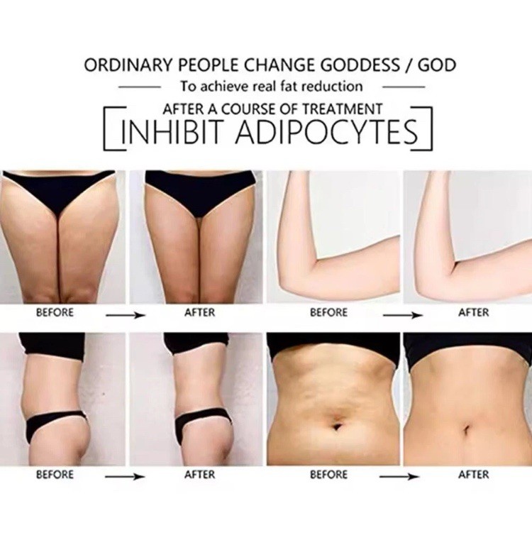 NEW 10+4 laser patch weight loss equipment Physical lipolysis relieve fatigue