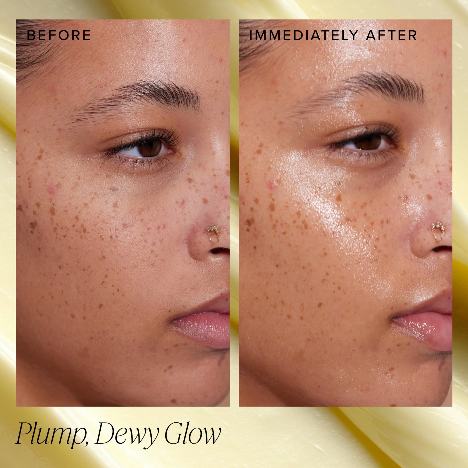 Hydrating Ceramide Face Moisturizer for Dry Skin – Plumps, Soothes & Restores Gl