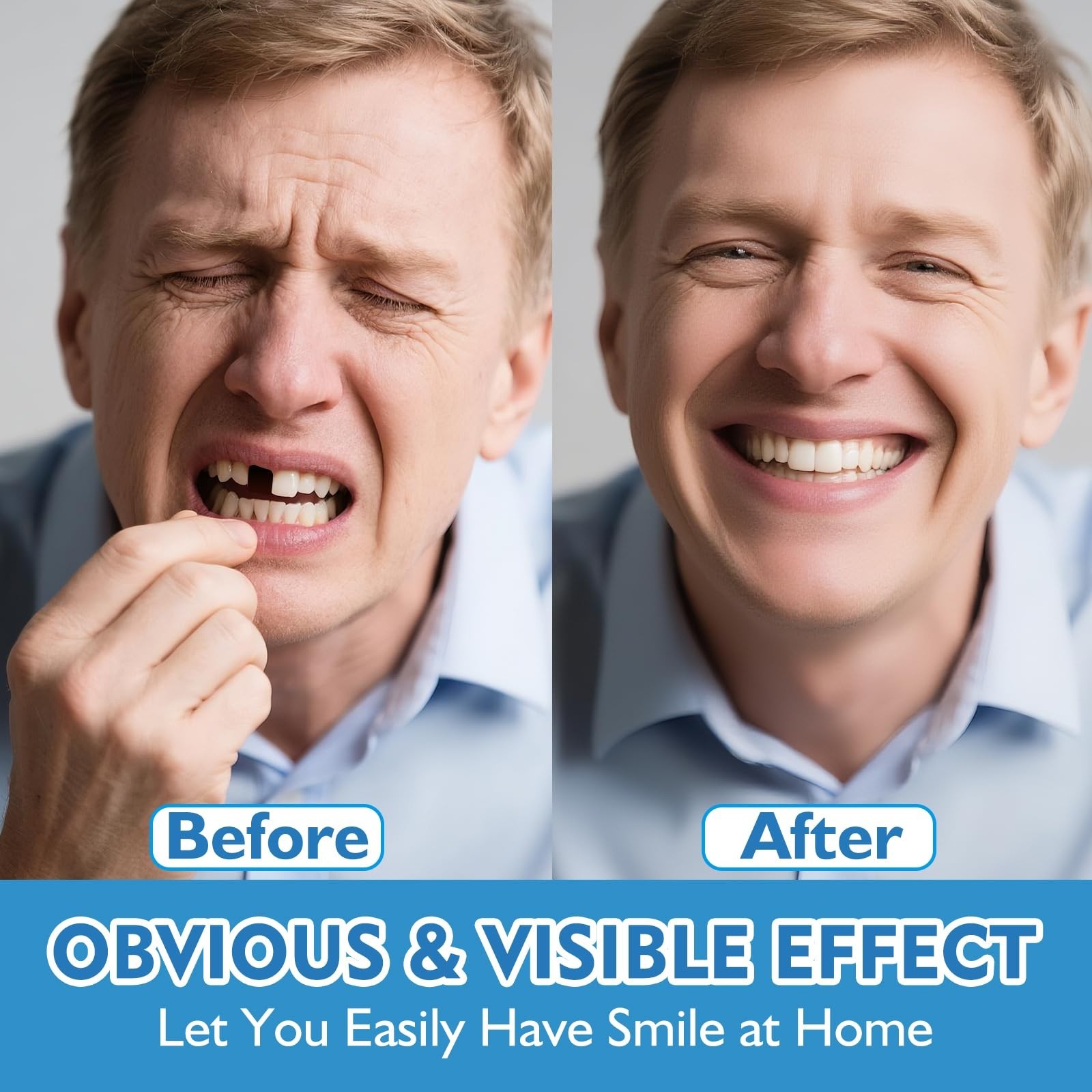 Moldable False Teeth – DIY Silicone Dentures Set for Upper & Lower, Temporary Sm