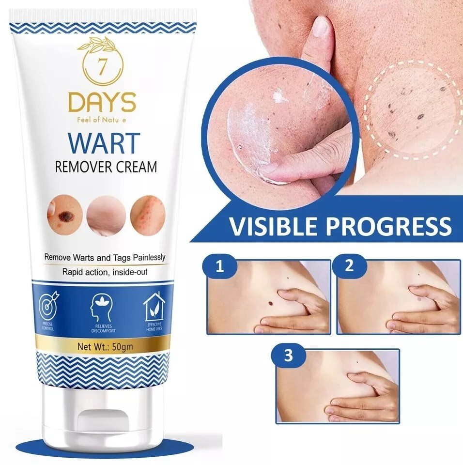 7 Days Genital Wart Removal Cream on Face, Neck, Forehead & Cheeks 50gm Pack