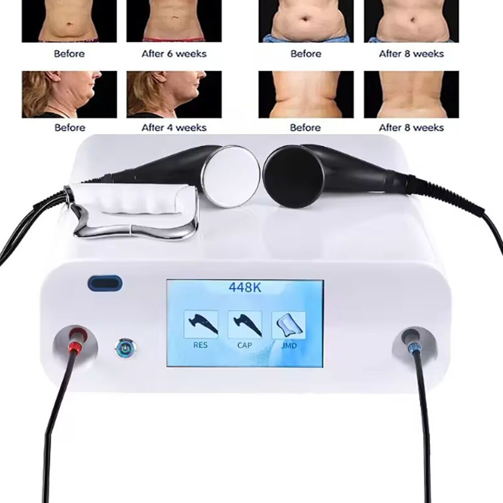 448K Fever Master RF Body Sculpting Machine Skin Fascia Massage Spa Device