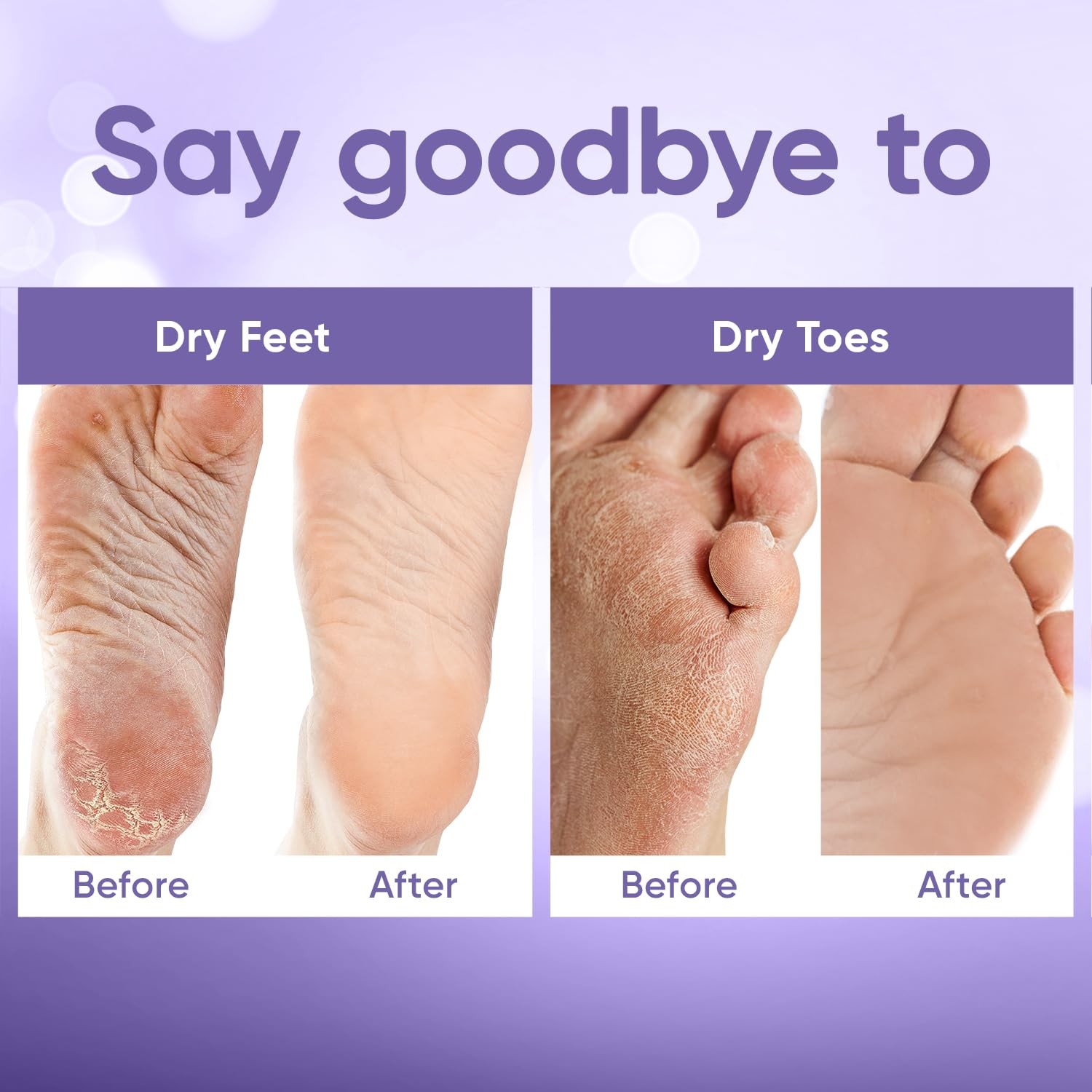 Foot Peel Mask – for Baby Soft Skin – 2 Pair (Pack of 1), White