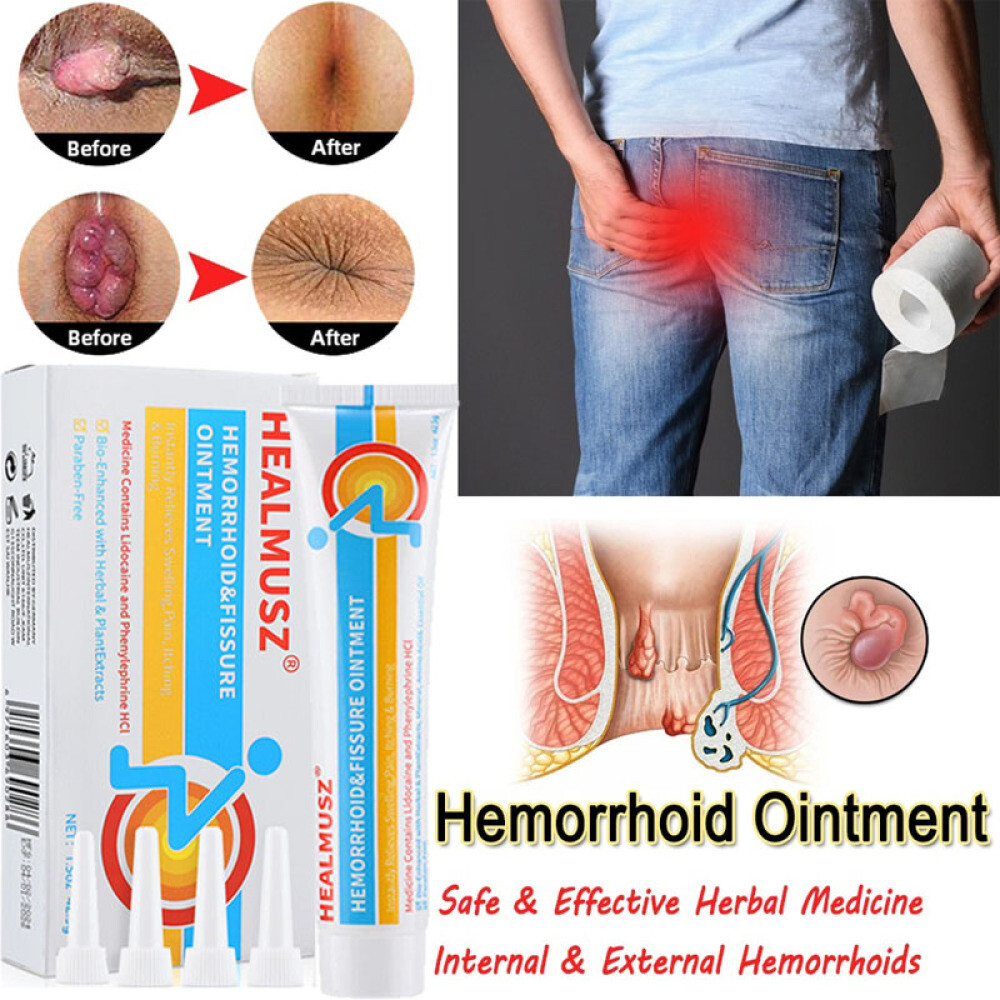 3/5PCS Hemorrhoids Remove Ointment Herbal Cream Relief Piles Pain Reduce Itching