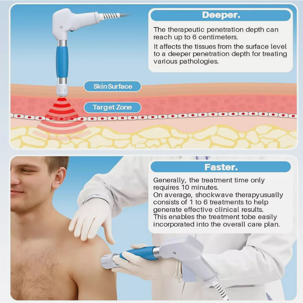 Kalecope Pneumatic ED Shockwave Therapy Machine Muscle Joint Pain Relief Massage