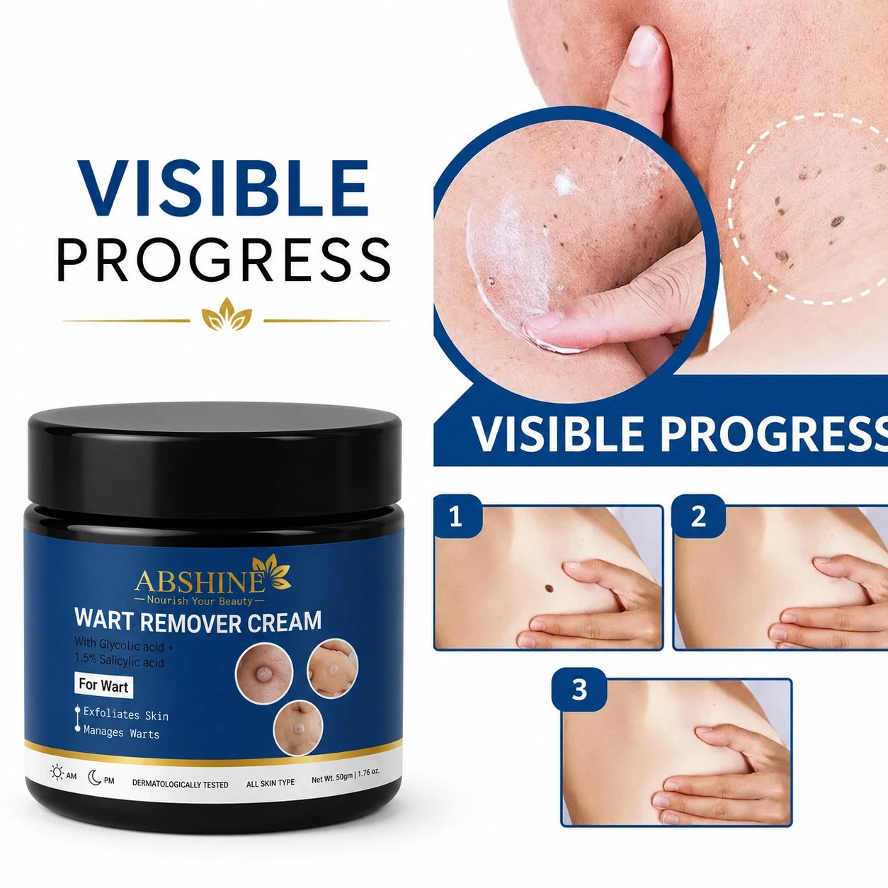 Genital Wart Removal Treatment Cream free packaging included 50 Gram (1.76 oz)