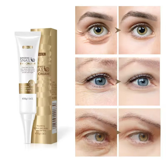 Remove Dark Circles Wrinkles, Lines Puffy Eyes, Moisturizer