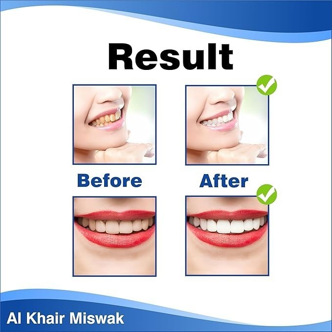 Al Khair Organic Miswak Sticks Natural Teeth Cleaning Herbal Roots – 5 PACK