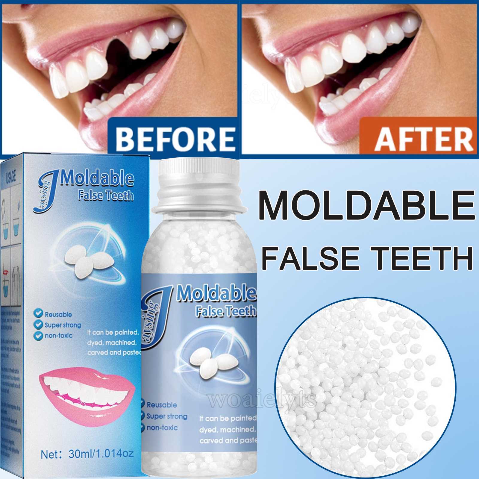US Tooth Repair Kit – Temporary Teeth Replacement Kit for Missing & Broken Teeth
