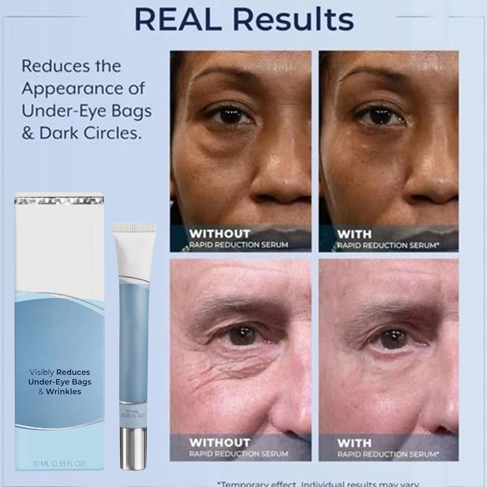 Plexaderm Rapid Reduction Eye Serum-Advanced Formula Anti Aging Wrinkles 10ml
