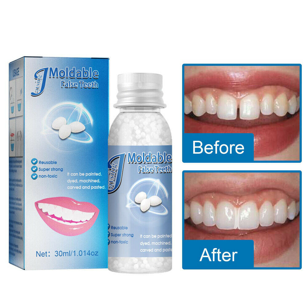 3× Resin False Teeth Solid Glue Temporary Tooth Gap Filler Tooth Repair Moldable