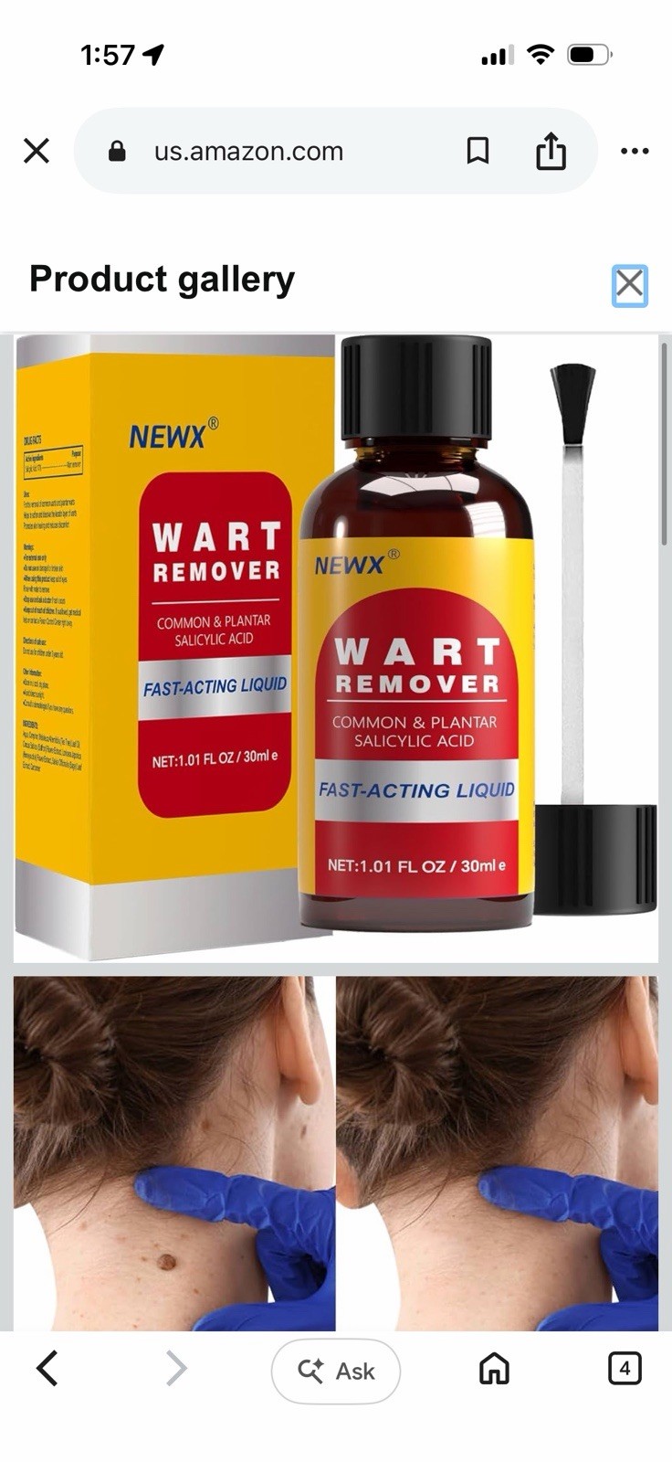 NEWX Fast-Acting Liquid Wart Remover 1.01 fl oz Salicylic Acid for Feet