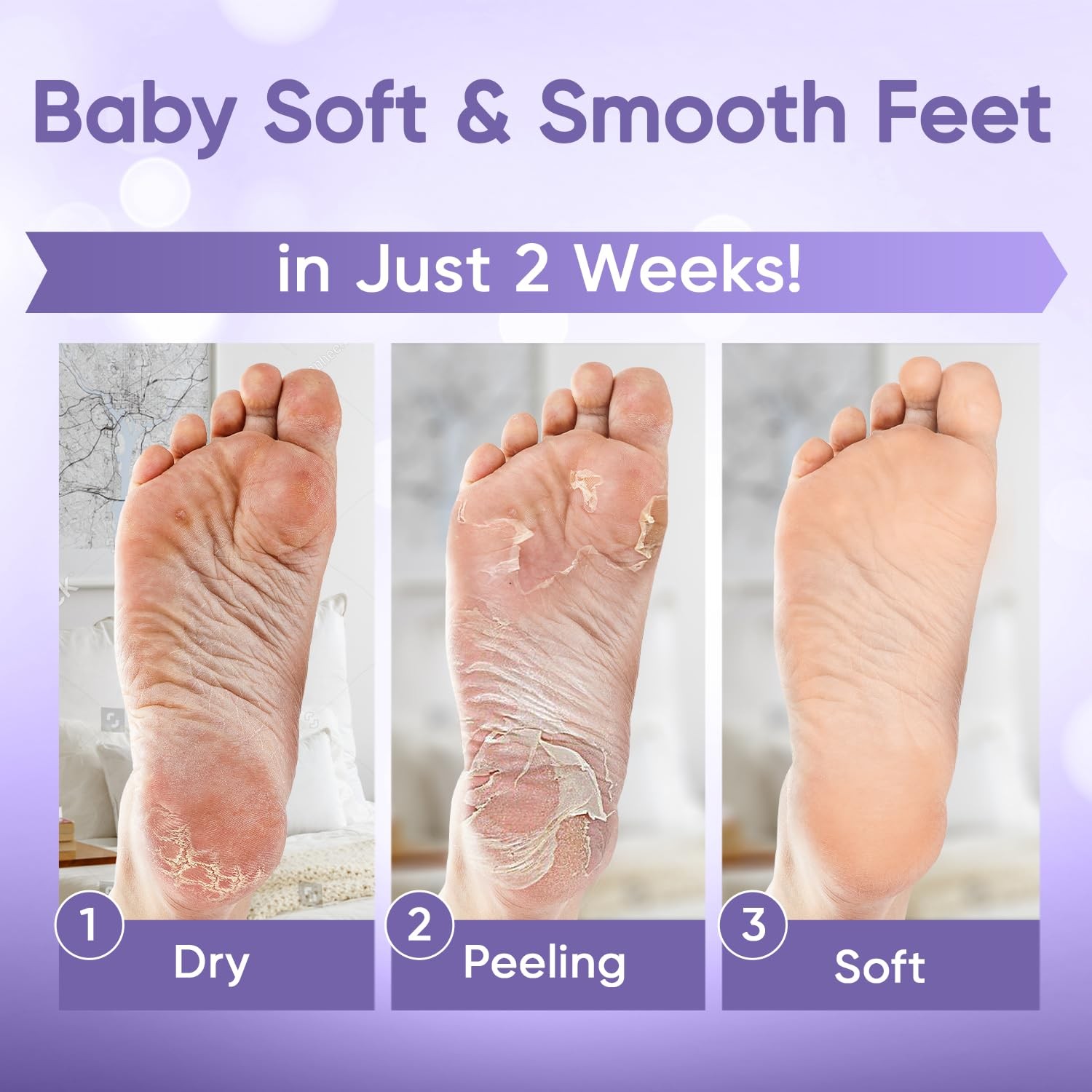 Foot Peel Mask – for Baby Soft Skin – 2 Pair (Pack of 1), White