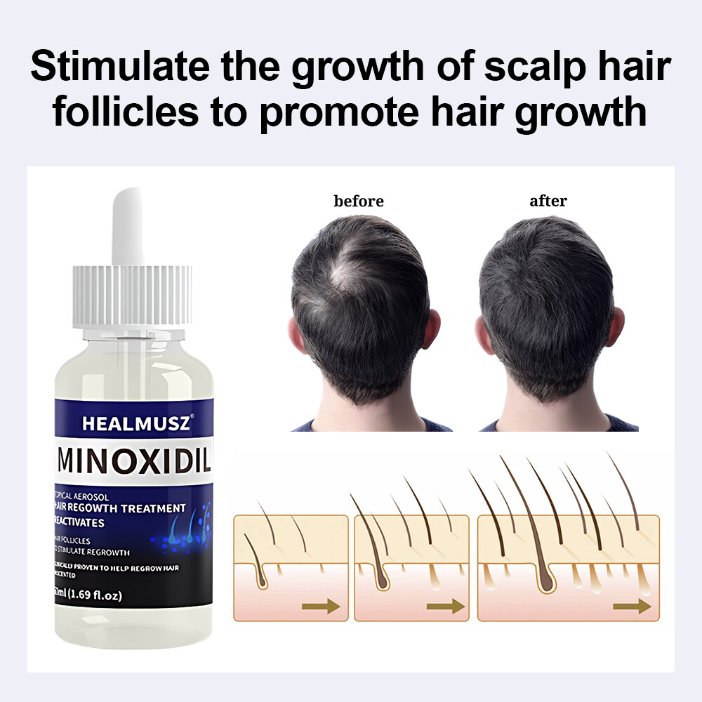 6PCS MINOXIDIL 5% EXTRA STRENGTH HAIR REGROWTH TREATMENT FOR MEN 6 MONTHS SUPPLY