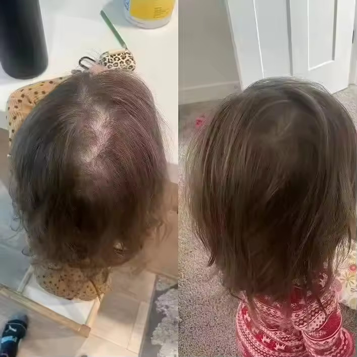 Hair Growth Essential Loss Regrowth Treatment Strengthens Hair Nourishes Scalp L