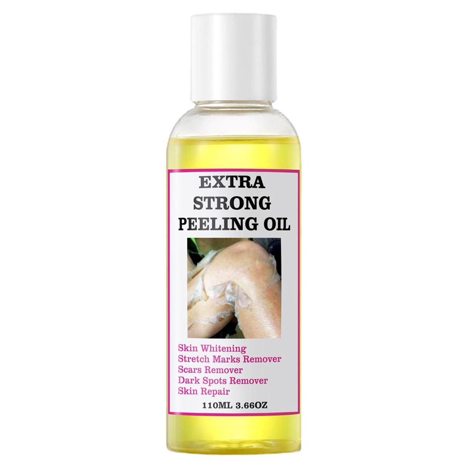 Yellow Strong Peeling Oil Exfoliating Solution for Face Body Dark Epidermal Knuc
