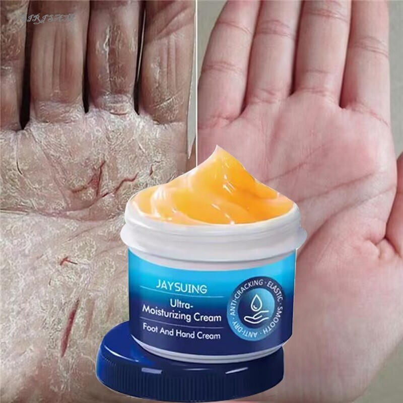 Crack Foot Hand Cream Heel Cracked Repair Dead Skin Removal Skin Care 30g